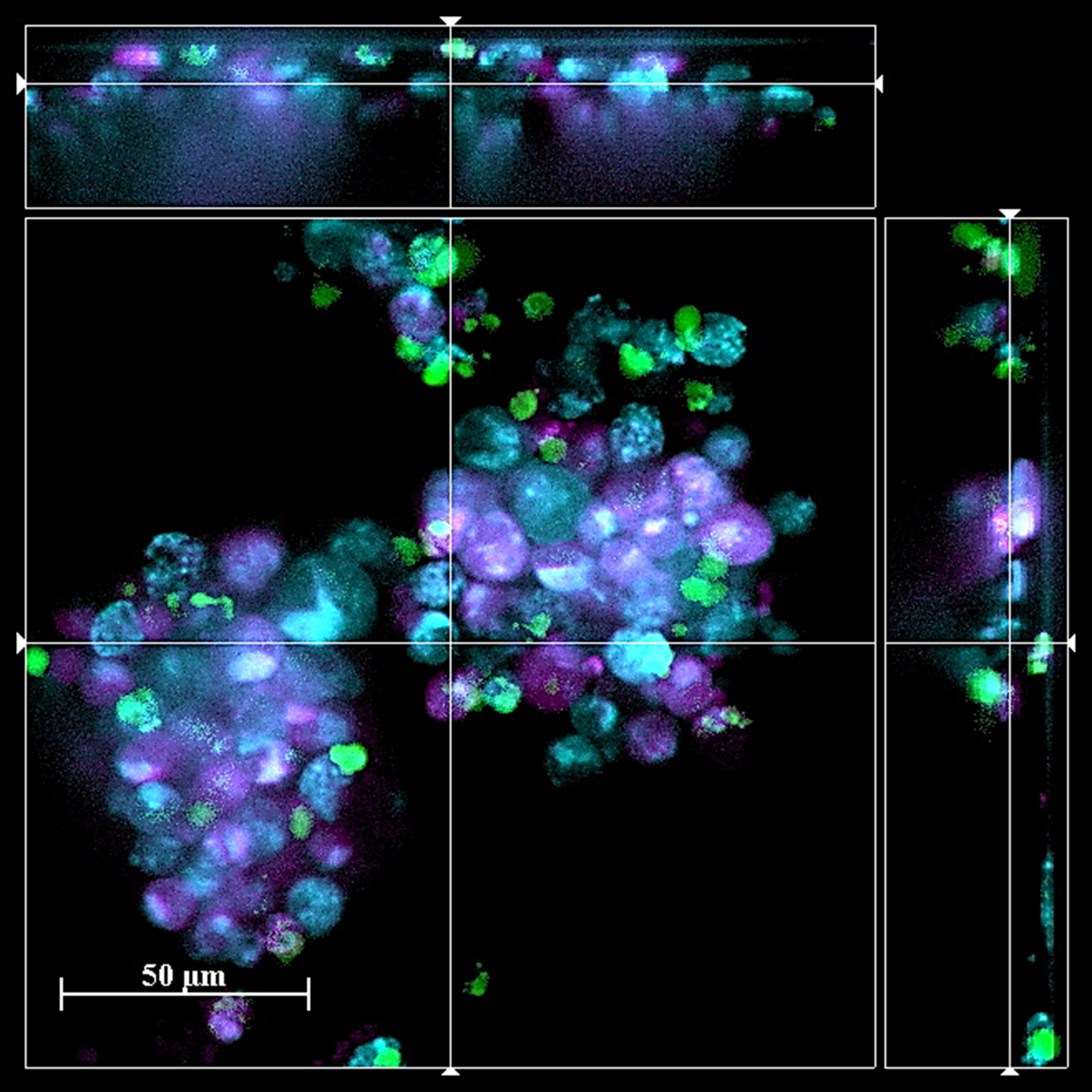 image represents the specific binding of mast cells (cyan) to cancer cells (purple)
